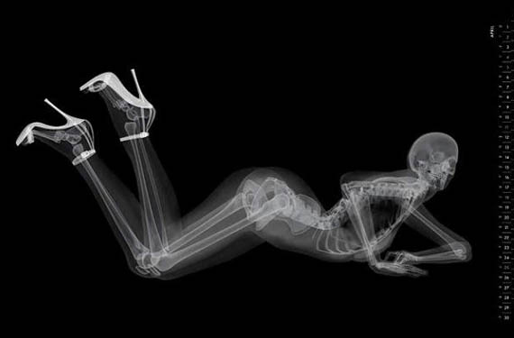 Eizo Medical Imaging Pin-Up Calendar