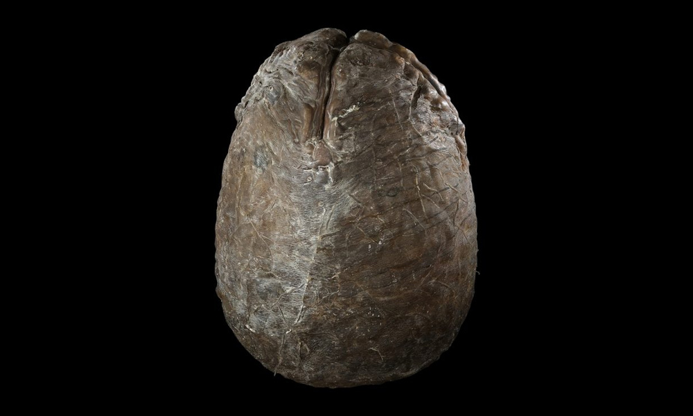 Alt Image