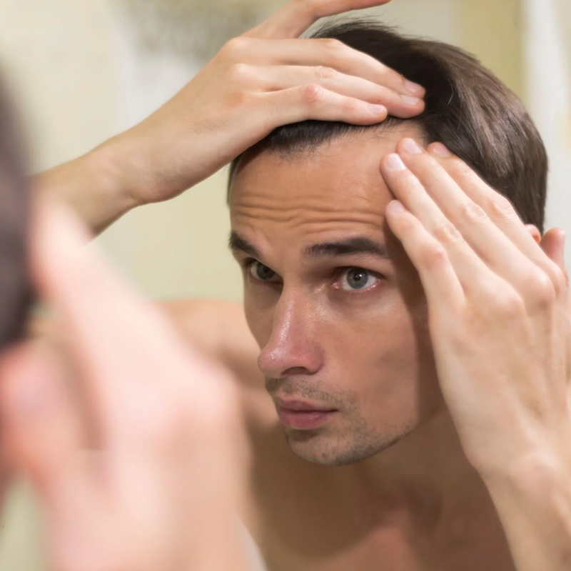 Regaining Your Confidence: Top Hair Growth Products for Men